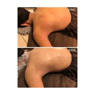 ピーリングサロン シャンテールのエステ・リラクイメージ