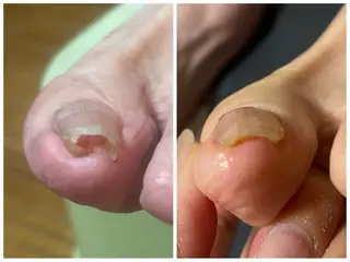 爪ケア専門店 peachill所属・大久保 桃子のネイルデザイン