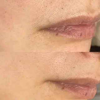 mone~total care salon~所属・mone (モーネ)のエステ・リラクイメージ