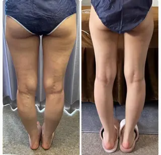 FLEUR 2号店のエステ・リラクイメージ