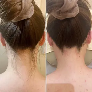 うなじ脱毛/美肌脱毛 LABELのエステ・リラクイメージ