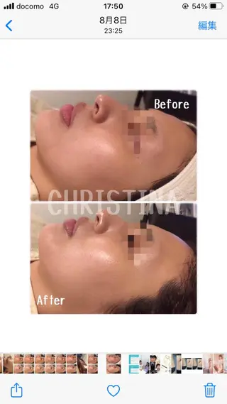 肌質改善サロンChouChou所属・肌質改善サロン chouchouのエステ・リラクイメージ