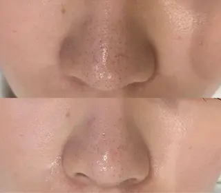 DeI'm   名古屋栄所属・小林 玲菜のエステ・リラクイメージ