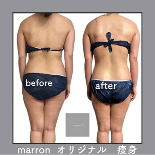marron所属・痩身ハイパーナイフ ララピールリアボーテのエステ・リラクイメージ