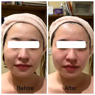 Relaxation SalonARONAのエステ・リラクイメージ