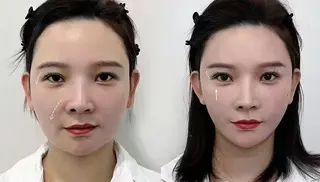 ネイル aliaハイフ&水光ジェットサロン所属・aliaハーブ水光店 エステティシャン募集のエステ・リラクイメージ