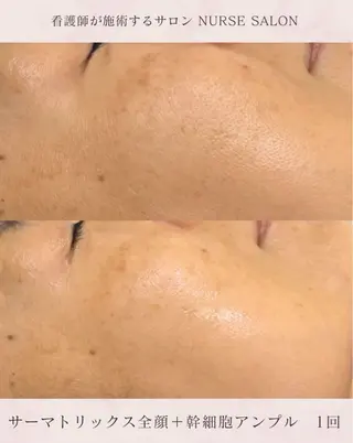 🌟看護師が施術🪄 ナスサロ/狩野のエステ・リラクイメージ