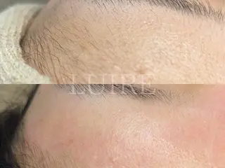 Facial Salon LUIRE所属・LUIRE　 ルイールのエステ・リラクイメージ