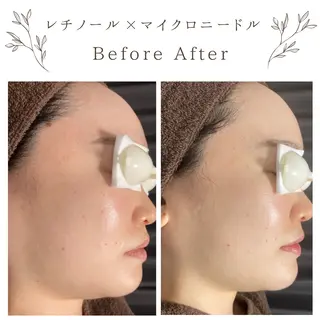 な ぎのエステ・リラクイメージ