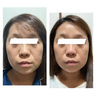 ポテンツァ&針美容 バストアップ専門店のエステ・リラクイメージ