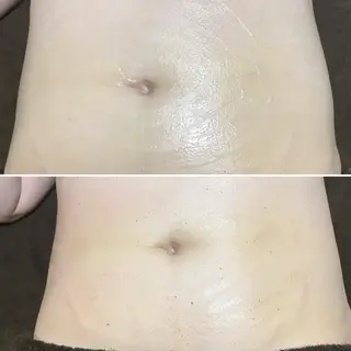 首・肩こり専門リンパ ケアサロンSENKAのエステ・リラクイメージ