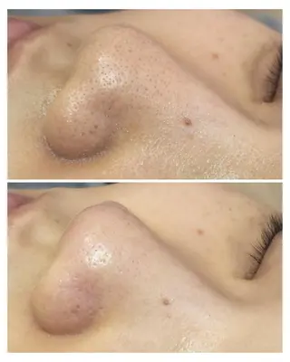 ALOHA RETREATのエステ・リラクイメージ