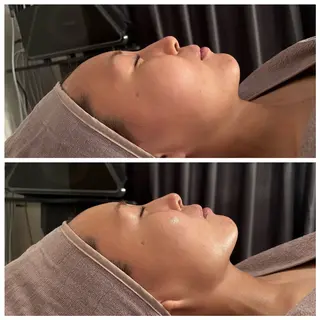 Private salon nA所属・若菜菜奈 本気の肌質改善 上島のエステ・リラクイメージ