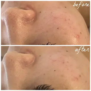 メンズ メナード岐阜市茜部 杉浦のエステ・リラクイメージ