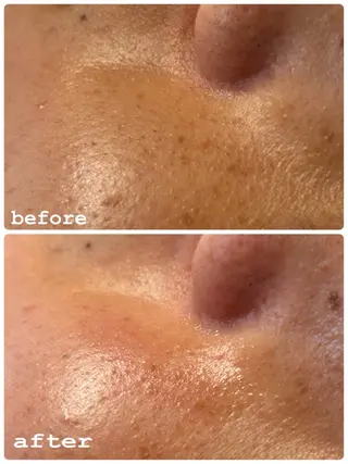 sourire.11 ‪☺︎‬‪emiのエステ・リラクイメージ