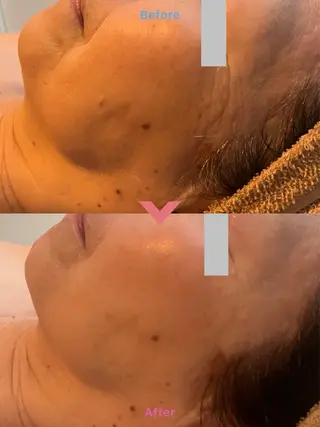 エステサロン Libertaのエステ・リラクイメージ