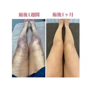 メディカル インディバサロン同心のエステ・リラクイメージ