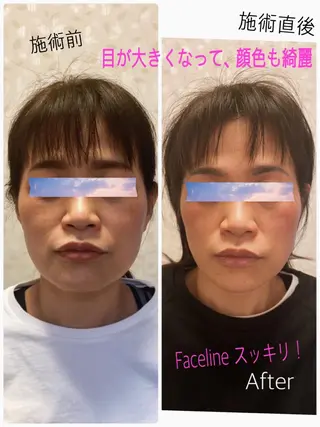 Anne’s happyBonesのエステ・リラクイメージ