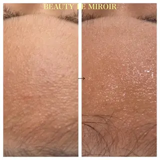 ビューティー ミロワールのエステ・リラクイメージ