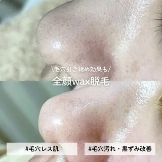 EST BEAUTY所属・顔ワックス脱毛/ ハーブピーリングのエステ・リラクイメージ