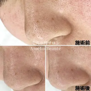 毛穴ケア専門サロン Amélio Beauté所属・毛穴ケア専門サロン アメリオボーテのその他イメージ