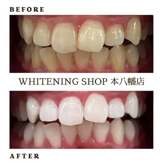 キッズ ホワイトニング ショップ本八幡店のエステ・リラクイメージ