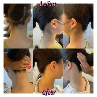 うなじ脱毛/美肌脱毛 LABELのエステ・リラクイメージ