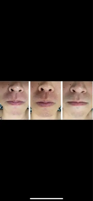 メンズ RE:moom リムーム/脱毛エステのエステ・リラクイメージ