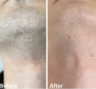 メンズ MEN‘S CARE メンズ脱毛サロンのエステ・リラクイメージ