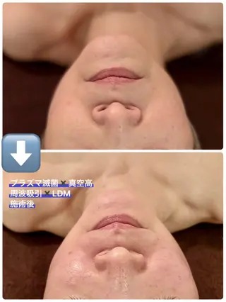 痩身/フェイシャル 💓KOUMA💓のエステ・リラクイメージ