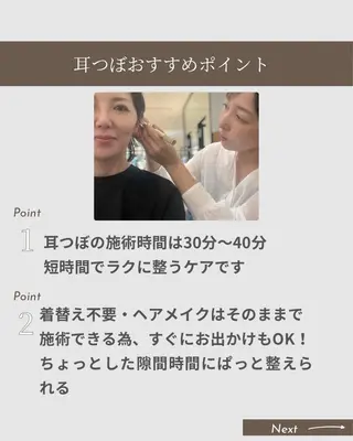 mimine エメラルド式耳つぼのその他イメージ