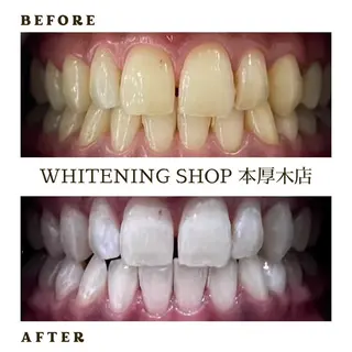 メンズ ホワイトニング ショップ本厚木のその他イメージ