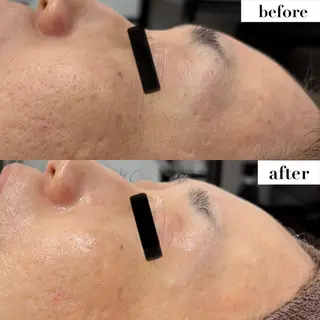 BLESS BEAUTYのエステ・リラクイメージ