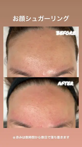 シュガーリング 【MARLS】の眉毛・アイブロウイメージ