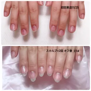 ネイル 深爪を断らない スカルプ高評価店のネイルデザイン