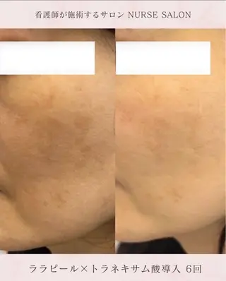 🌟看護師が施術🪄 ナスサロ/狩野のエステ・リラクイメージ