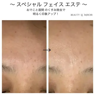ビューティー ミロワールのエステ・リラクイメージ