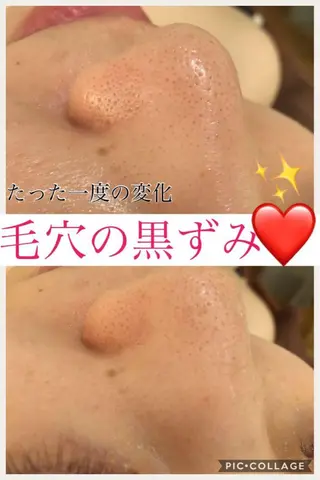 ミディアム カラー パーマ ヘアアレンジ メンズ キッズ ネイル マツエク・マツパ ニキビ・肌質改善専門 ♡人生が変わるサロンのエステ・リラクイメージ