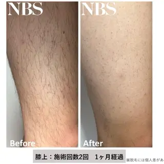 メンズ トータルビューティー サロン　Lisseの眉毛・アイブロウイメージ