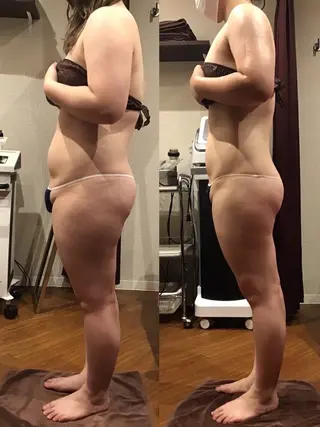 espresso,所属・《痩身、小顔専門店》 エスプレッソのエステ・リラクイメージ