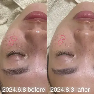 アイブロウ&フェイシャルサロンa‘lm所属・WAX脱毛/肌質改善 眉毛とお肌のサロンのエステ・リラクイメージ