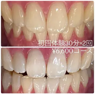 PLATINUM Beauty 横浜店所属・ホワイトニングルーム 横浜店のその他イメージ