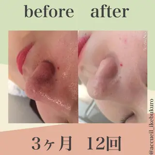 ミディアム カラー パーマ ヘアアレンジ メンズ キッズ ネイル マツエク・マツパ ニキビ・肌質改善専門 ♡人生が変わるサロンのエステ・リラクイメージ