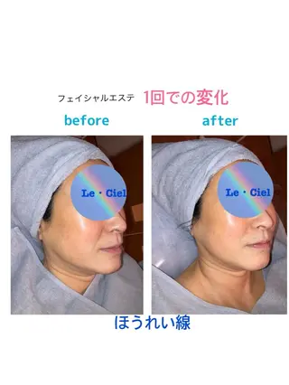 フェイシャルエステLe・Ciel所属・Le・Ciel フェイシャル&ボディのエステ・リラクイメージ