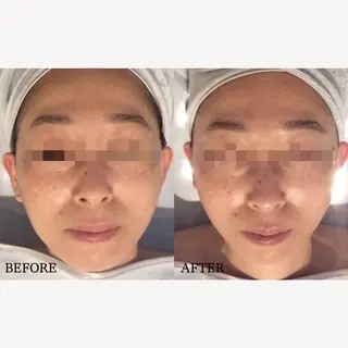 BIB PIBのエステ・リラクイメージ