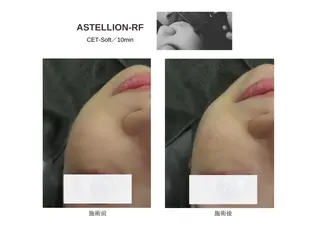 Sylphya (シルフィア)のエステ・リラクイメージ