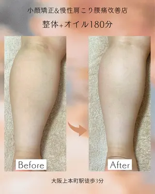 小顔矯正& 慢性肩こり腰痛改善店のエステ・リラクイメージ