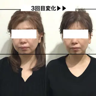 顔の歪み矯正専門 宮内翔のエステ・リラクイメージ