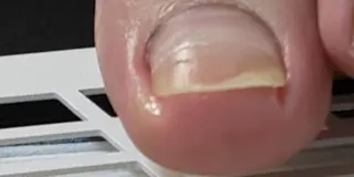 ネイル 爪屋 Orchidのネイルデザイン