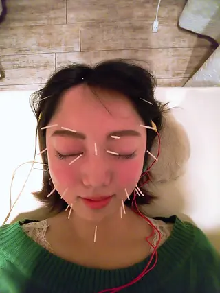 むくみたるみ専門☆ 美容鍼・小顔矯正のエステ・リラクイメージ